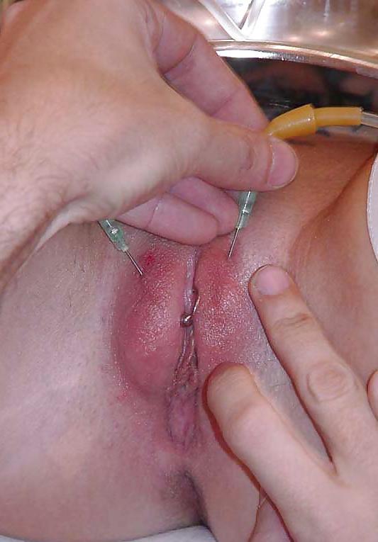 25P Salin injection pussy and nipple