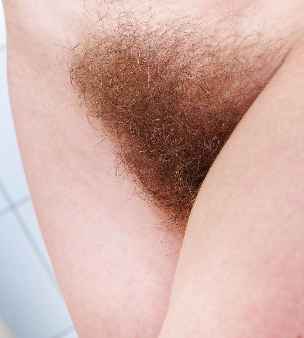 25P When I was younger, hair grew on my vagina