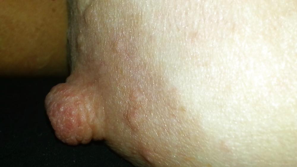 6P For nipple lover's. 