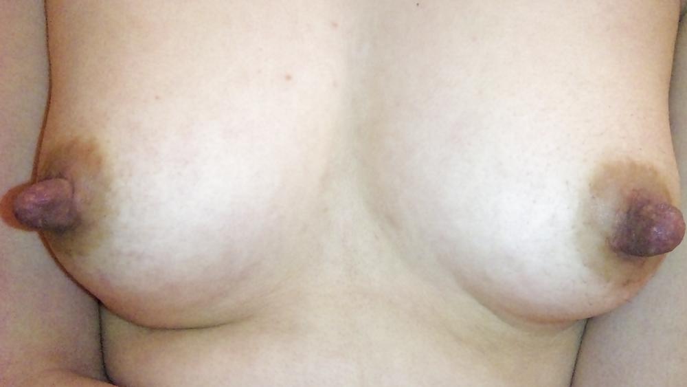25P Nipple mania