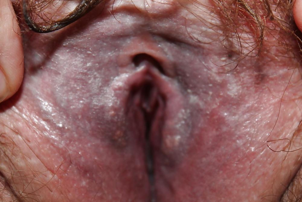 25P German BBW Hairy Pussy 2013
