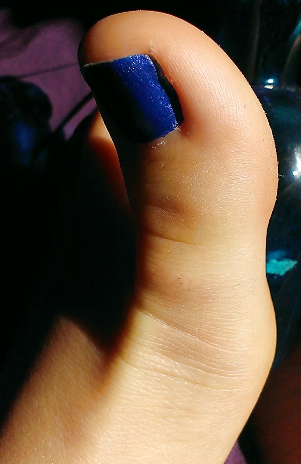 15P Dagyo - feet
