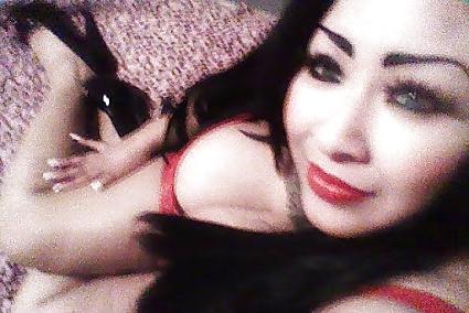 12P Huge latia cleavage