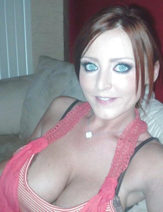 20P Cleavage - 3