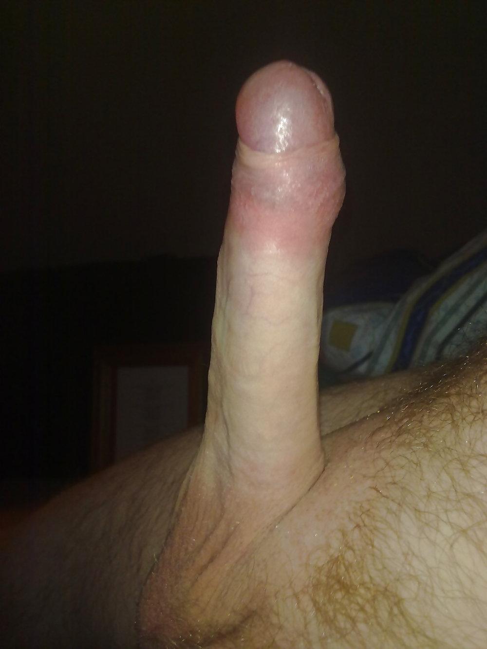5P Excuse the ugly mush :-)