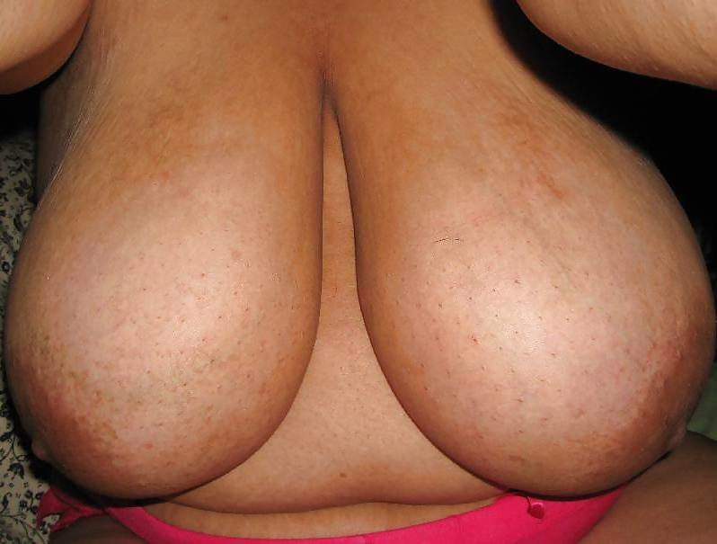 25P Extreme Macromastia Black Boobs 2