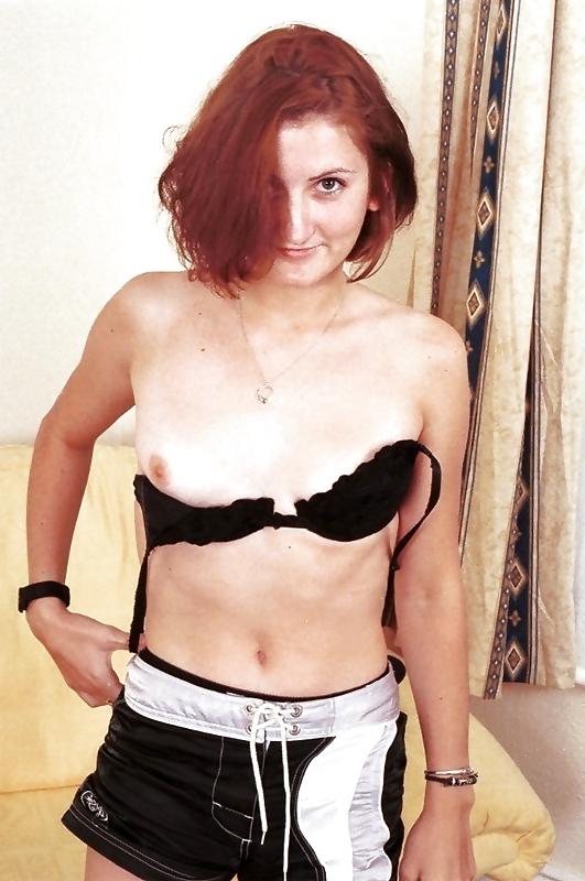 25P Red Hair and Freckles Vol. 4