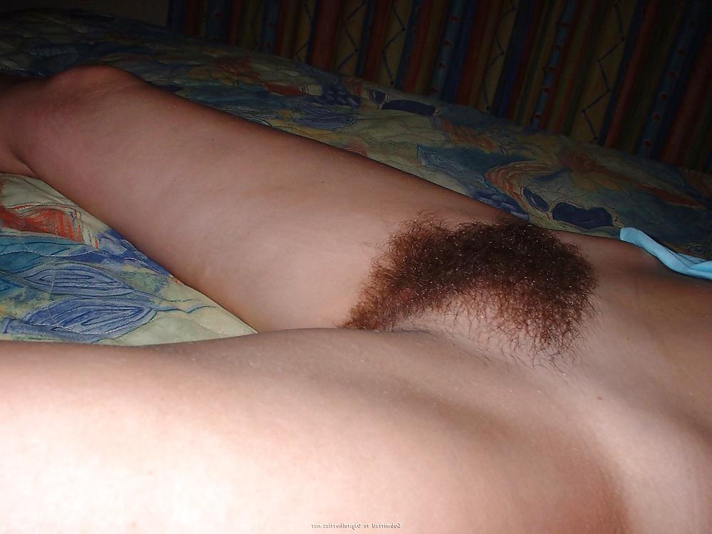17P Jill hairy and no hair