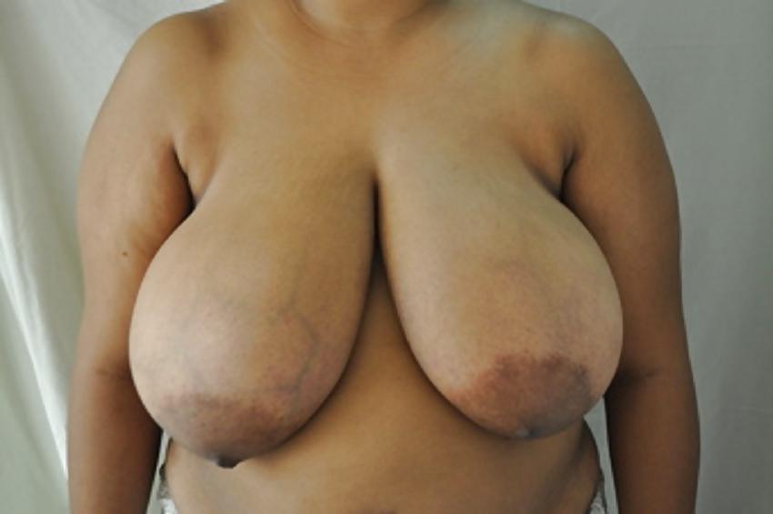 25P Big black areolas ----massive collection---- part 26 