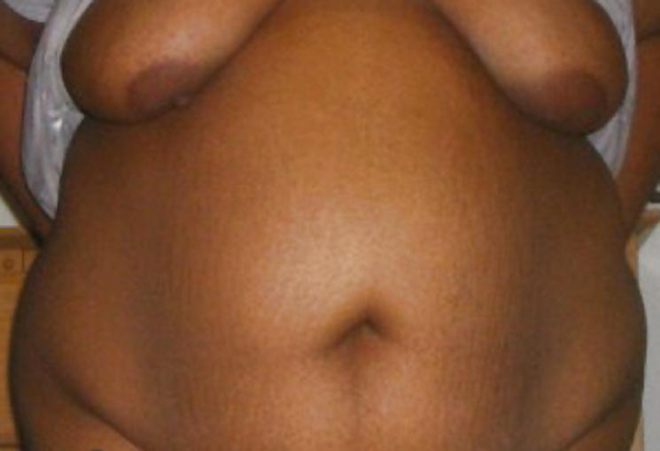 25P Big black areolas ----massive collection---- part 26