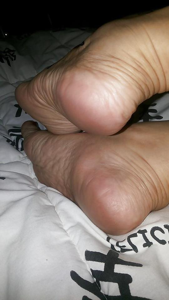20P Feet Mature