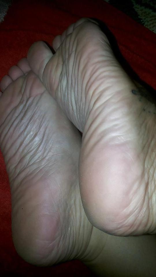 20P Feet Mature
