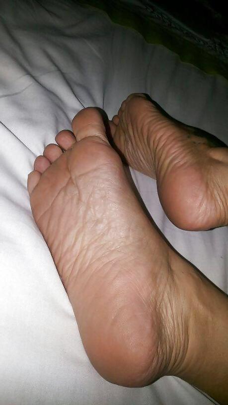 20P Feet Mature