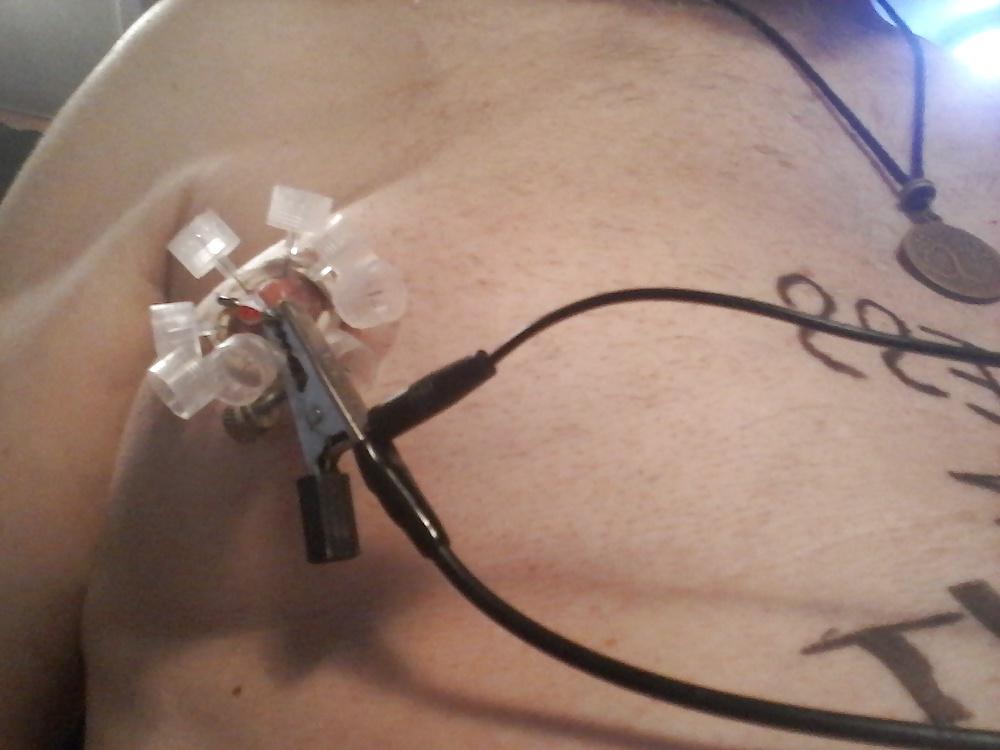20P Nipple treatment