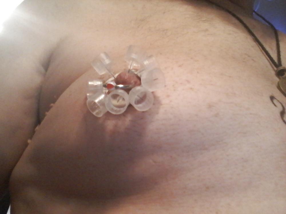20P Nipple treatment