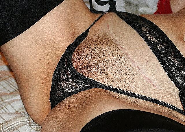 25P Pubic hair showing in panties or bikini