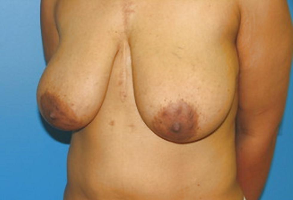 25P Big black areolas part 32