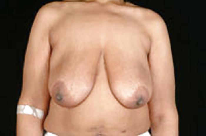 25P Big black areolas part 32