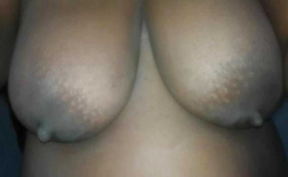 25P Big black areolas part 30