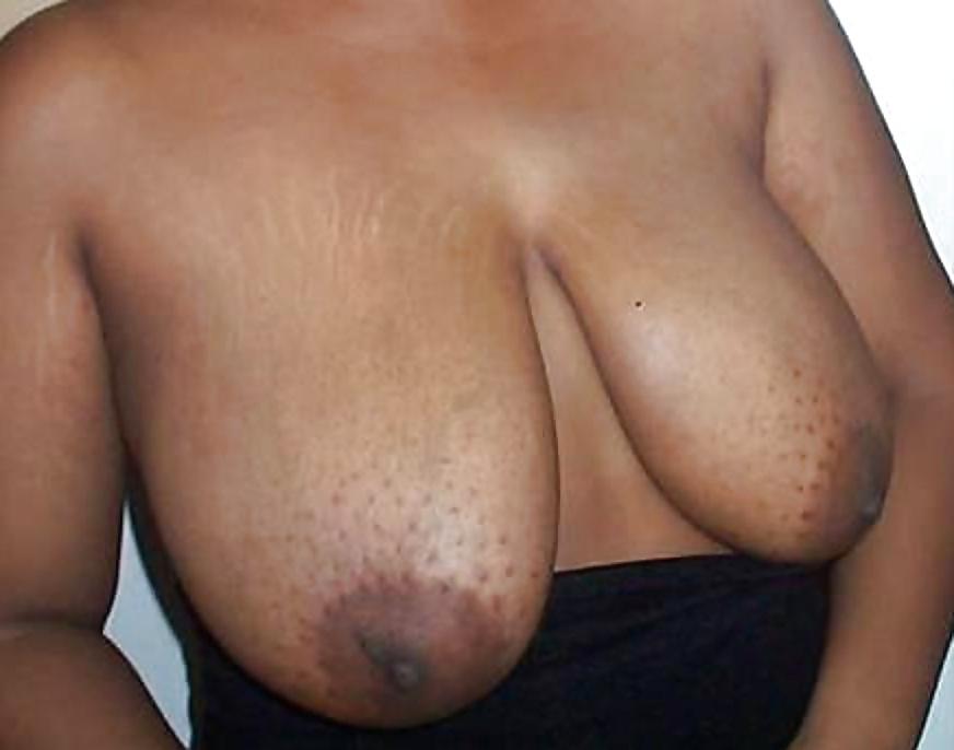25P Big black areolas part 30
