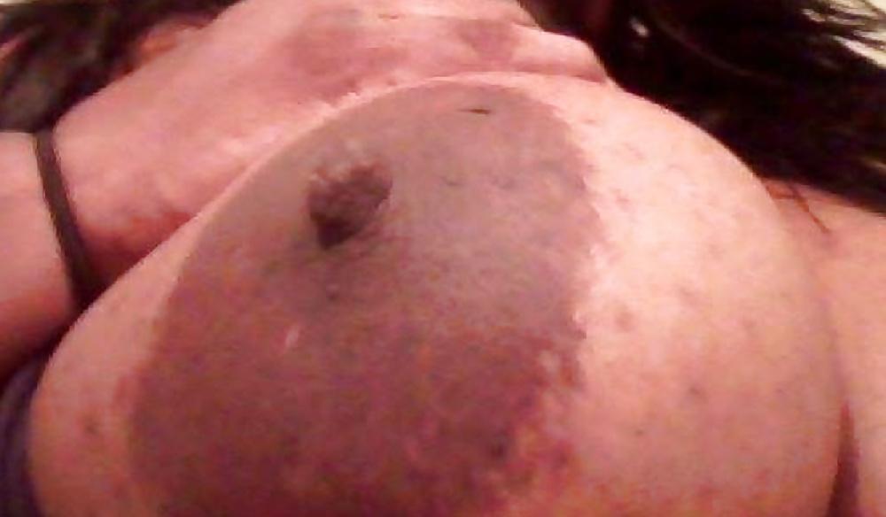 25P Big black areolas part 30