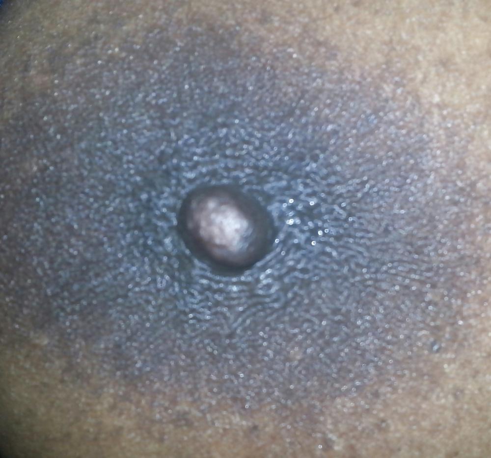 5P Nipple 1114