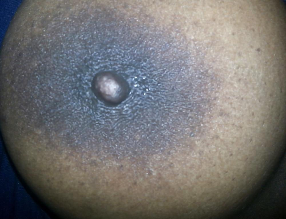 5P Nipple 1114