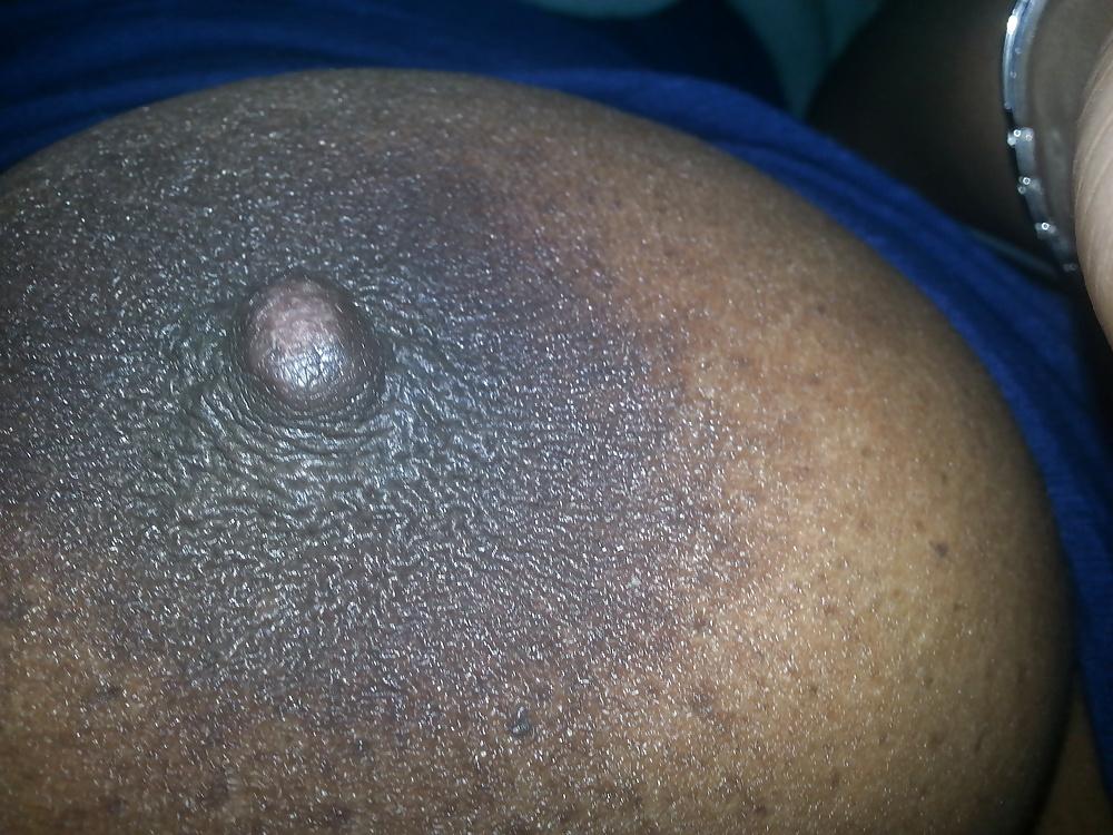 5P Nipple 1114