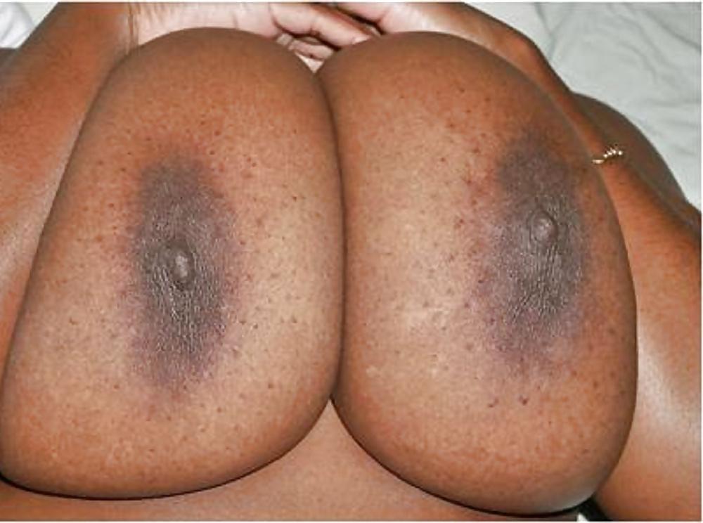 25P Big black areolas part 31