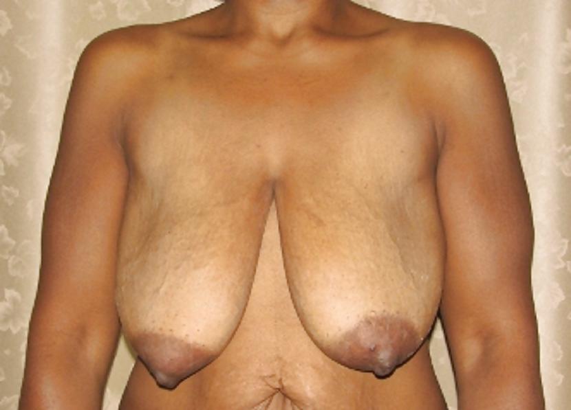 25P Big black areolas part 31