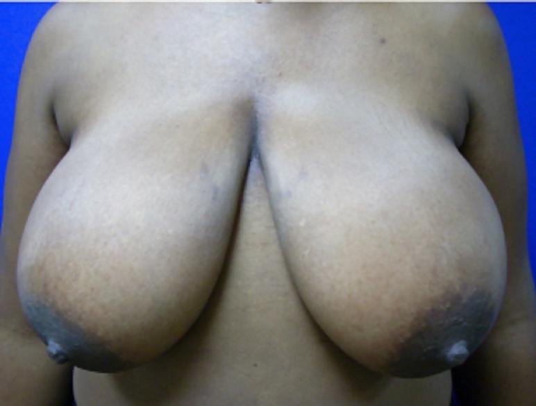 25P Big black areolas part 31