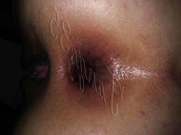 11P Turkish Whore idil From Bodrum 25.10.2014