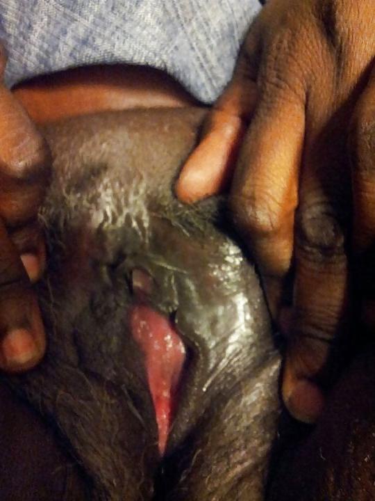 25P Grey pussy hair