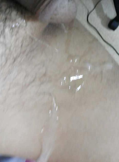 25P Prostate orgasm: Clear and Milch