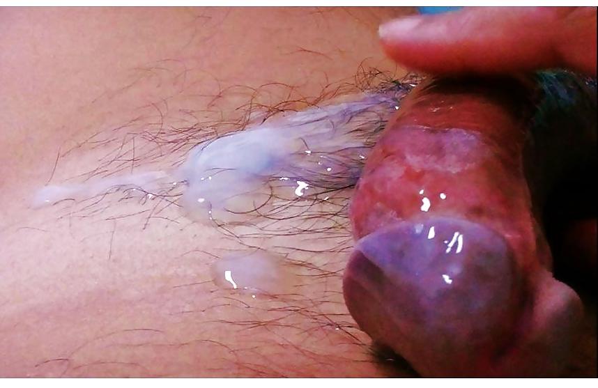 25P Prostate orgasm: Clear and Milch