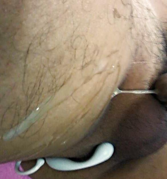 25P Prostate orgasm: Clear and Milch