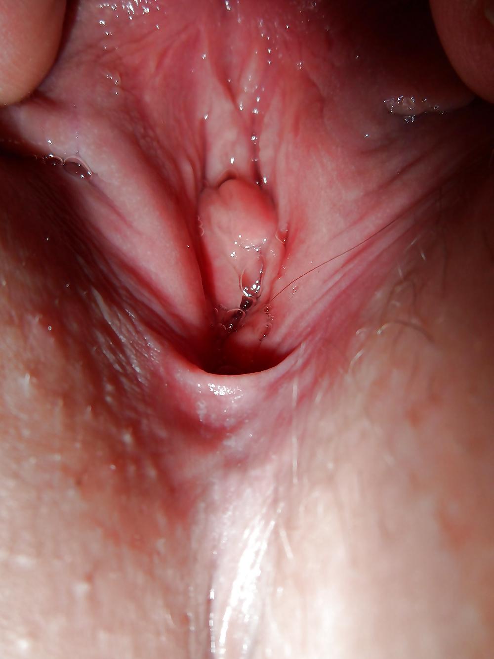 5P Penetration