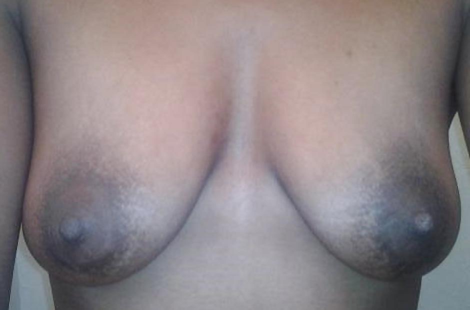 25P Big black areolas ----massive collection---- part 28