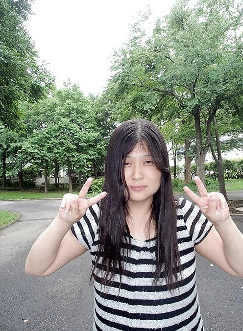5P Public exposure in the park