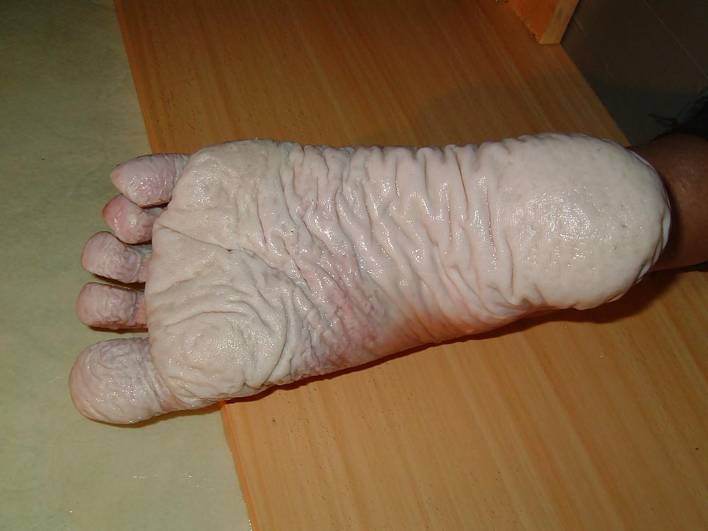 13P Bianca's 24 to 80 hours wet feet