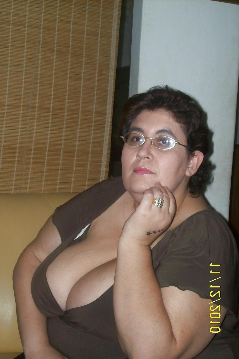 25P Mature cleavage 2