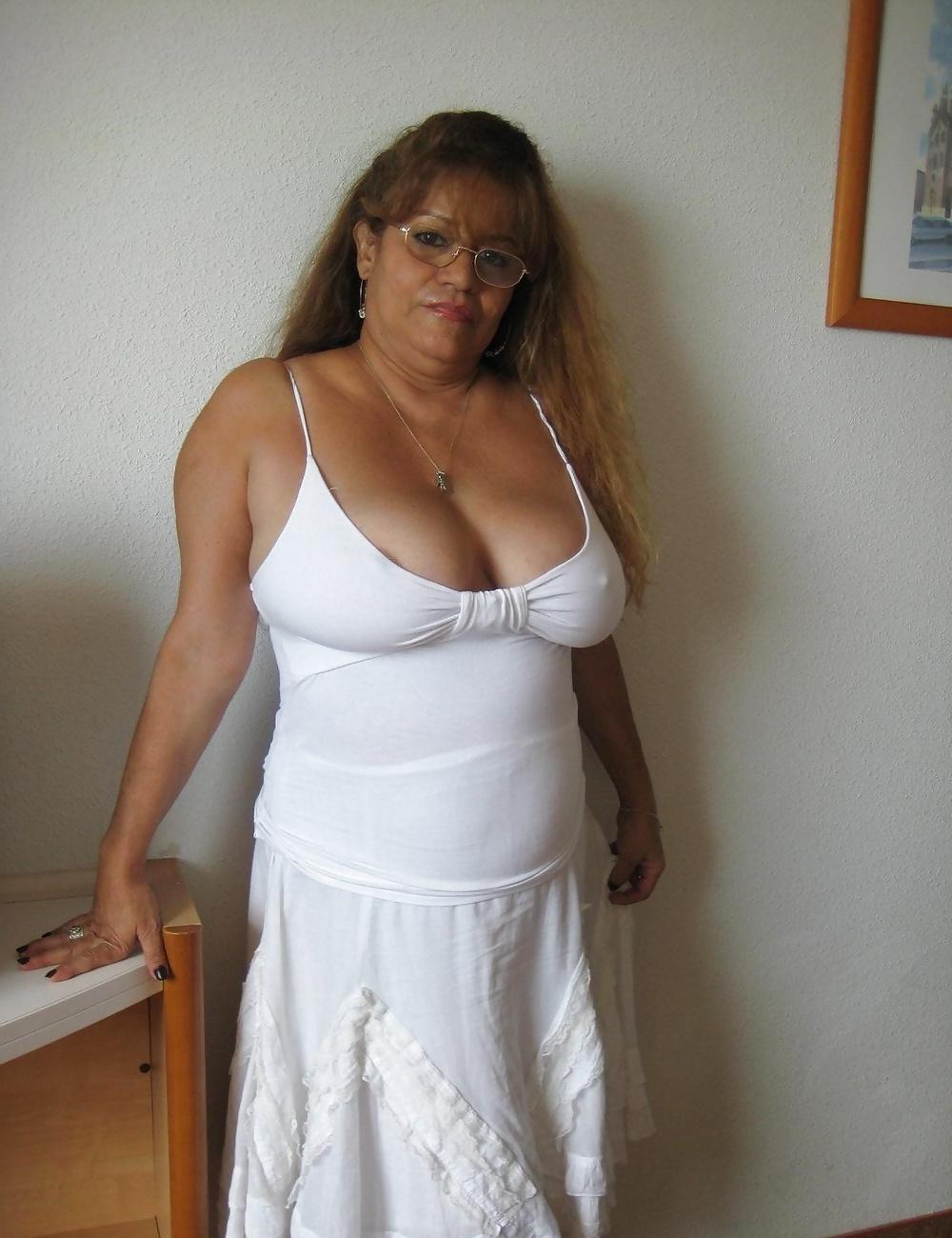 25P Mature cleavage 2