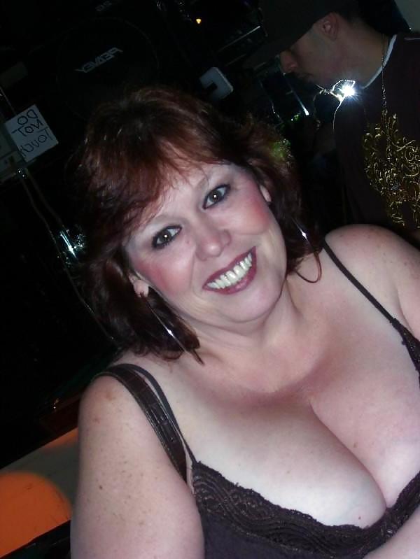 25P Mature cleavage