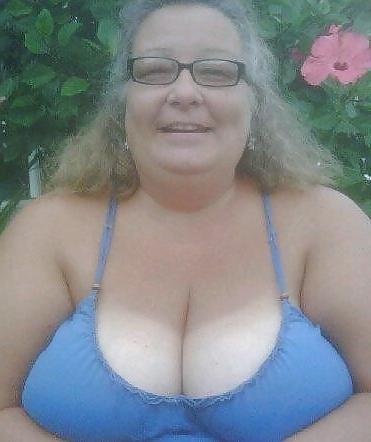 25P Mature cleavage