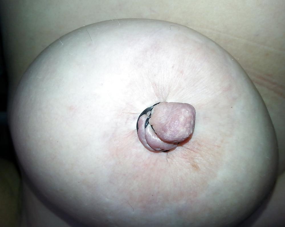 9P Nipple use