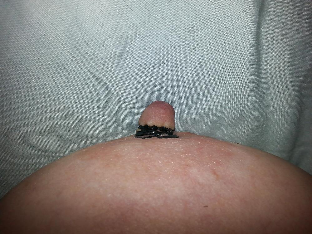 9P Nipple use