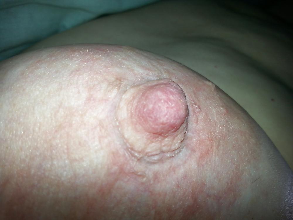 9P Nipple use