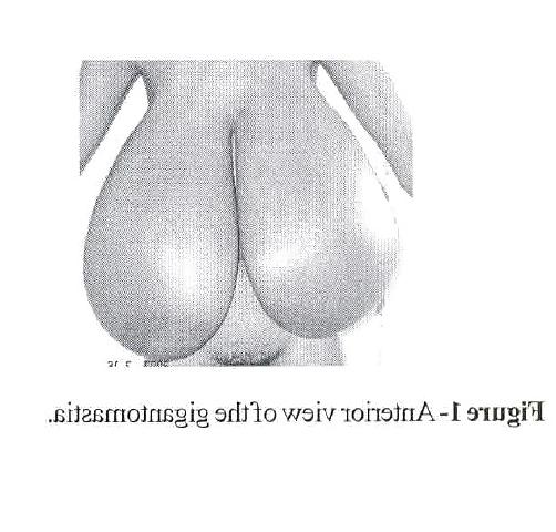 20P Extreme Macromastia Black Boobs 9