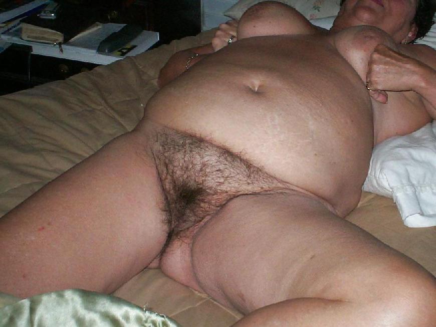 24P Pubic hair