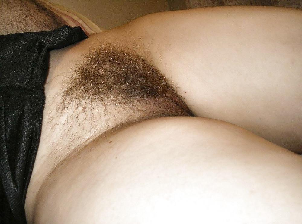 24P Pubic hair
